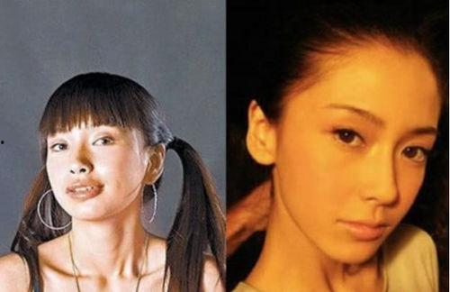 明星整形吃瓜爆料视频